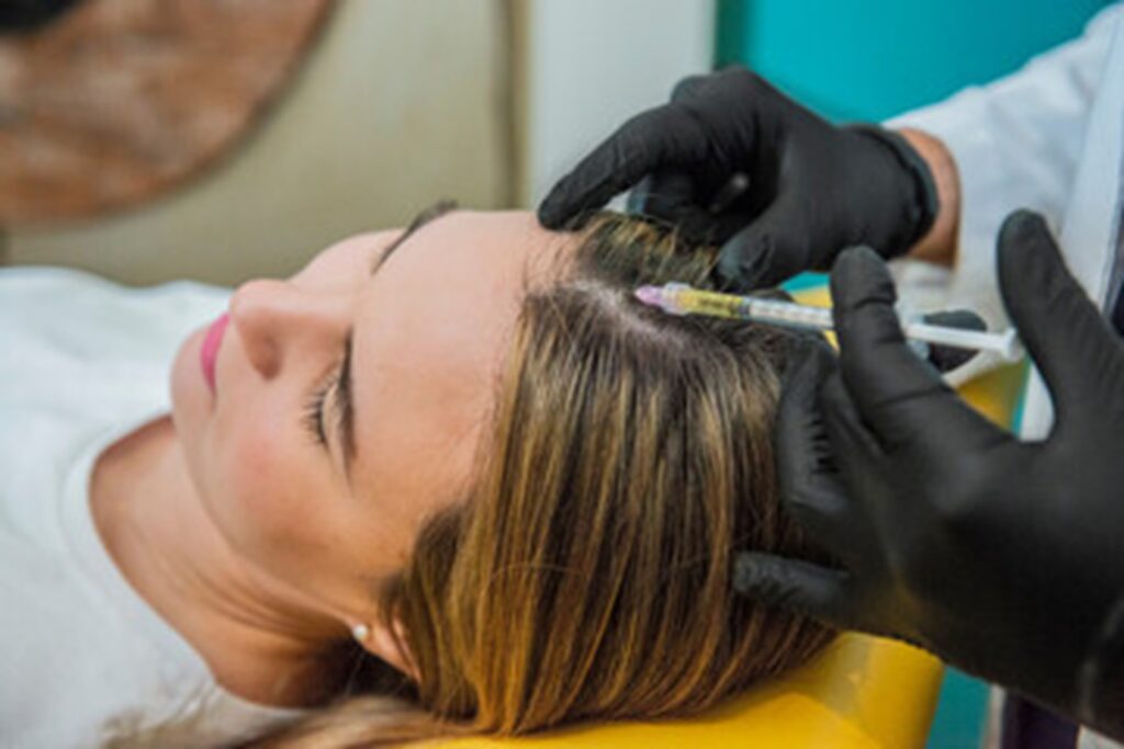 PRP Hair loss treatment Newcastle under Lyme/Crewe Cheshire