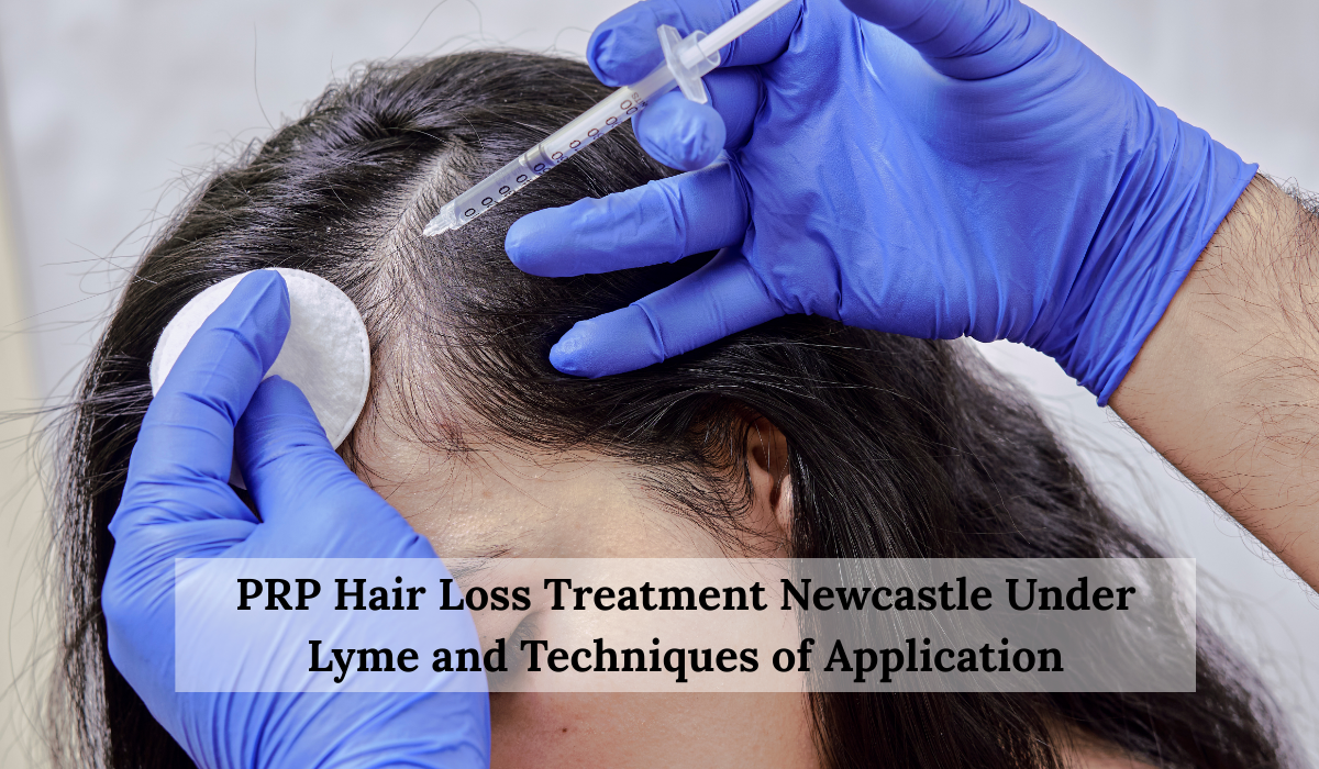 PRP Hair Loss Treatment
