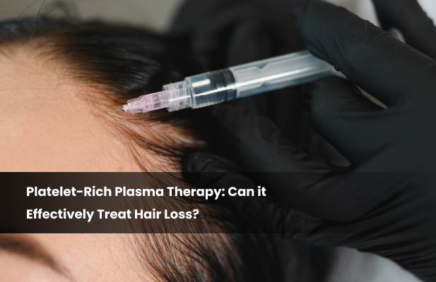 Platelet-Rich Plasma Therapy_ Can it Effectively Treat Hair Loss_