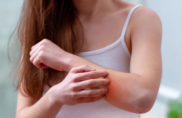 Allergy Intolerance Test in Newcastle Under Lyme 2